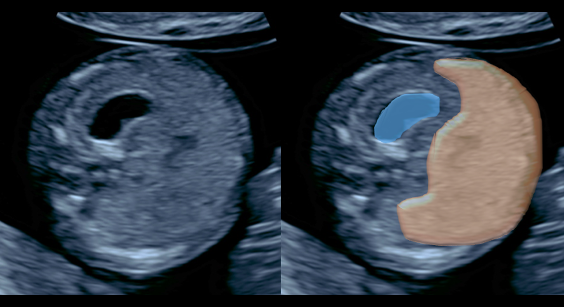 Anatómia bruška v 12. tg – modrá farba znázorňuje žalúdok, hnedá pečeň