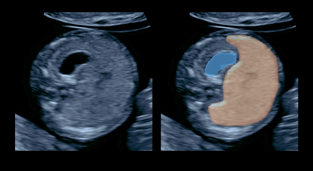 Anatómia bruška v 12. tg – modrá farba znázorňuje žalúdok, hnedá pečeň
